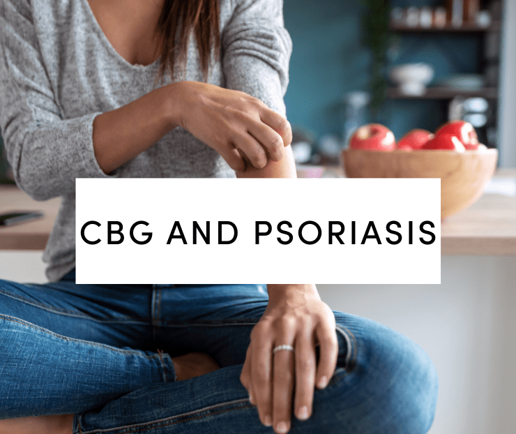 cbg and psoriasis