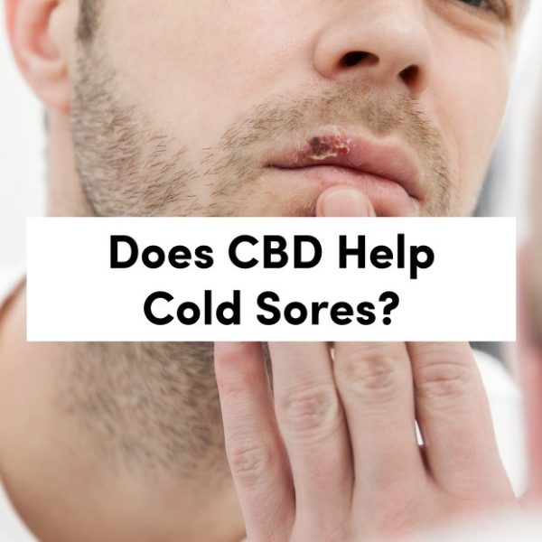 Does CBD Help Cold Sores Find Out Here Tanasi