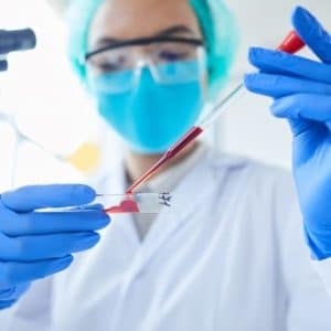 Will CBD Test Positive - HEALTH WORKER ANALYZING A BLOOD SAMPLE
